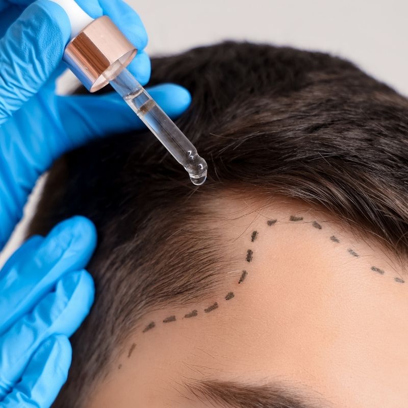 Sağlıklı Saçlar İçin Saç Derisi Bakımı Neden Şart?