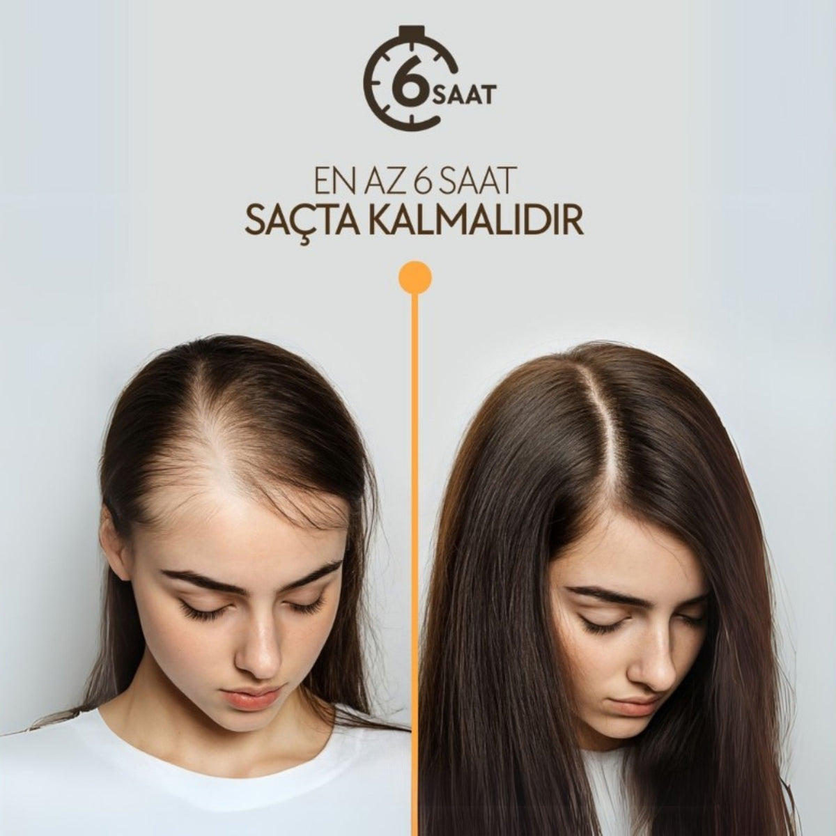 La Rachel dökülmeye karşı bakım serumu ile güçlü saç görünümü