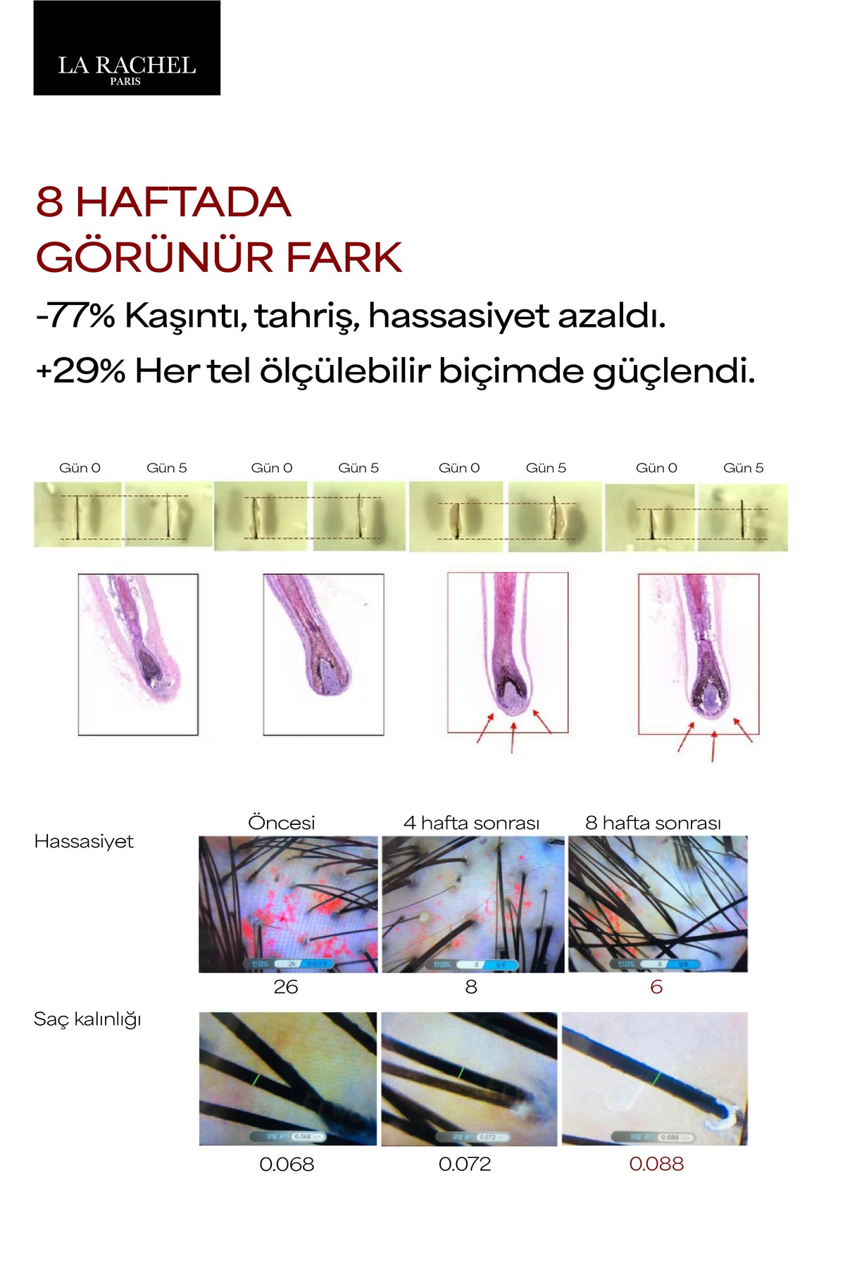 La Rachel Procapil saç serumu, saç derisi bakım analizi ve düzenli kullanım görseli
