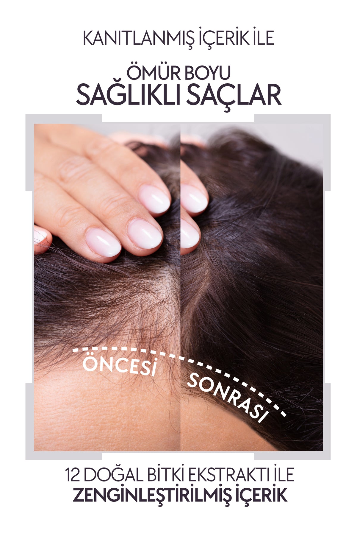 La Rachel Procomplex şampuan, saç derisi ve saç teli bakım desteği